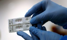 Atnaujinta COVID-19 ligos testavimo tvarka ir epidemijų skelbimo kriterijai